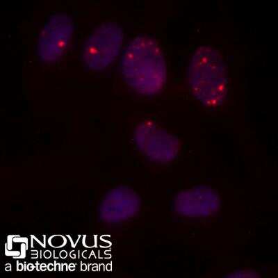 Immunocytochemistry/Immunofluorescence Staining of 53BP1 in HeLa Cells Using Conjugated 53BP1 Antibody